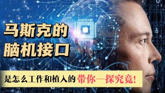 什么是脑机接口技术？如何将其应用在孤独症干预中？(图1)