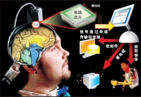 苹果脑机接口技术突破：用意念控制iPhone引领AI创新潮流(图1)