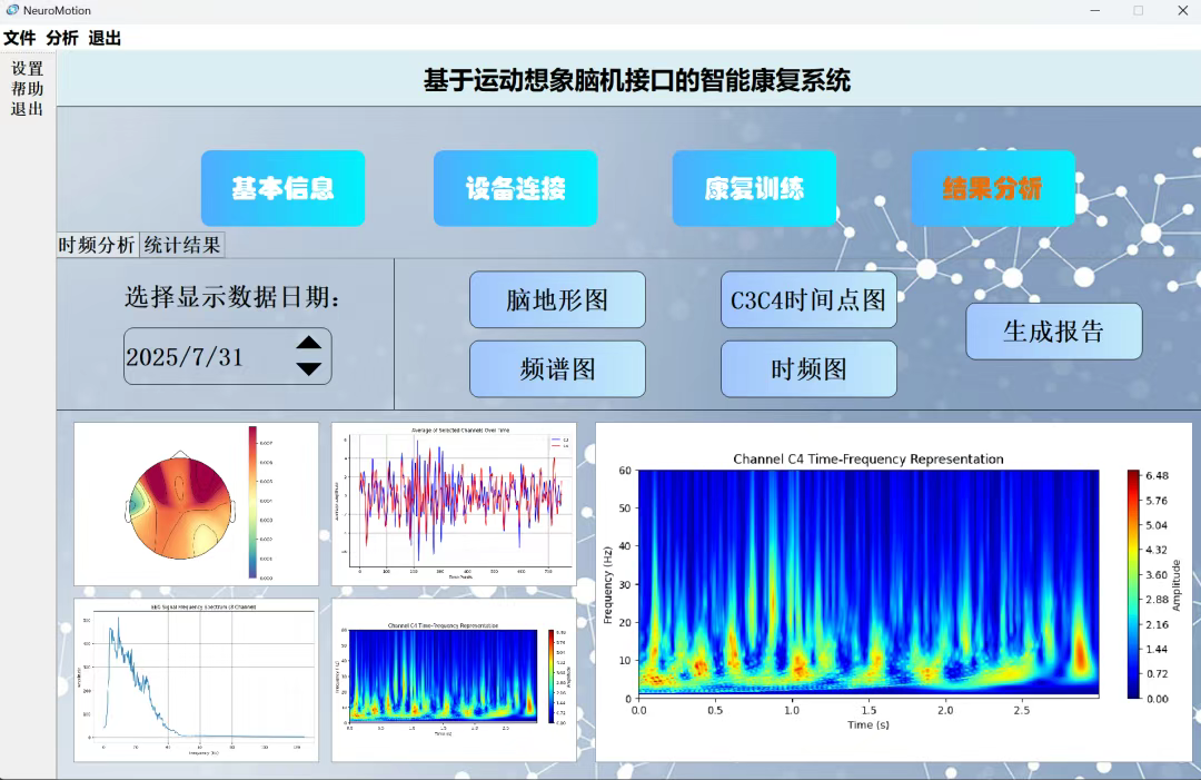 脑机接口技术新突破！苏州高新区这家“国字号”院所发布重磅成果(图3)