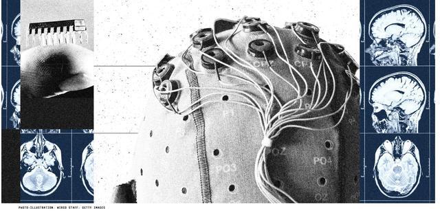 全球媒体聚焦丨美国科技媒体：从概念到产品 中国加速脑机接口技术商业化进程(图3)