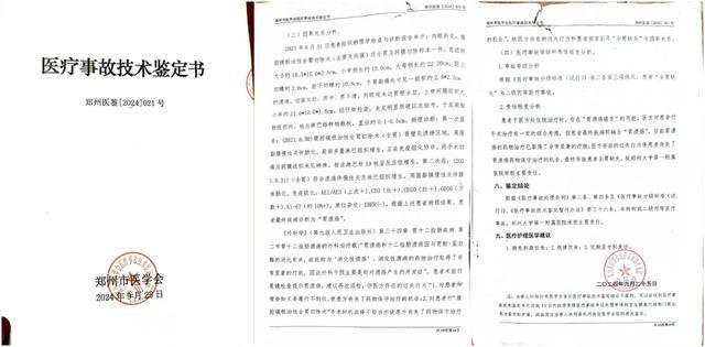 医生左右不分把支架装进正常输尿管三名医生医疗事故仅处罚一助手(图10)