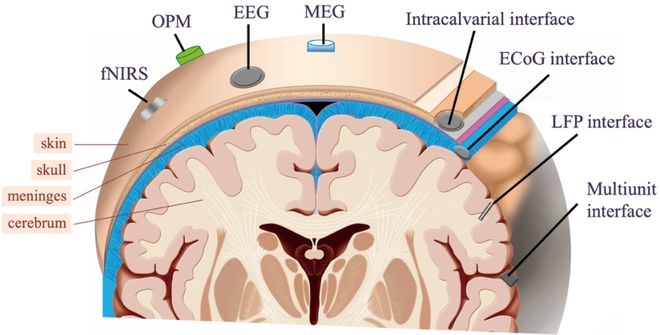 「脑机接口」系统综述发布：全景解析理论、技术、挑战、趋势(图5)