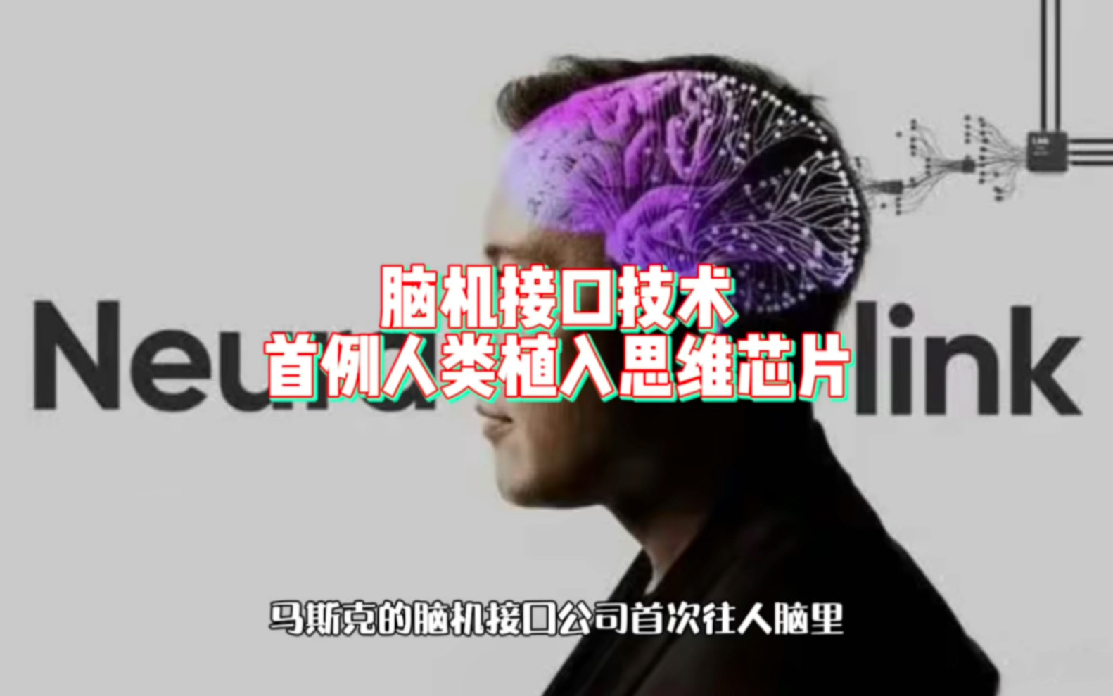 脑机接口三大赛道最全龙头公司名单(图1)