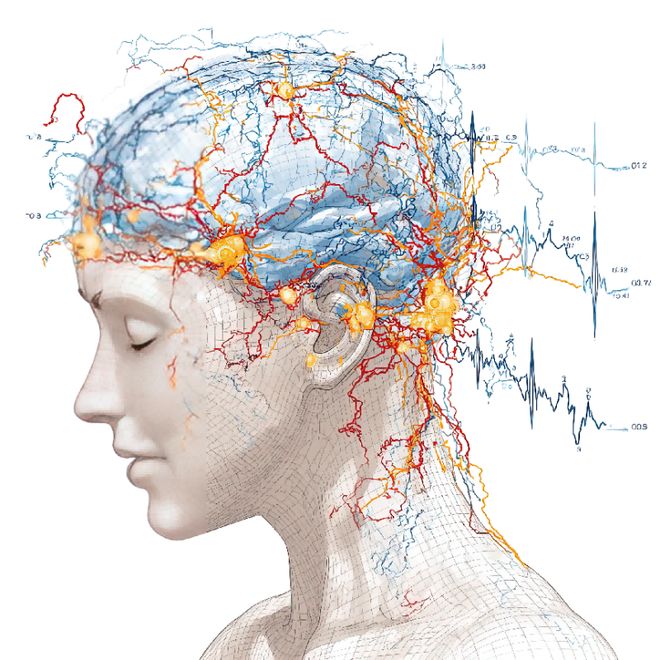 技术破局瑞尔唯康如何在国际癫痫监测市场实现弯道超车(图4)