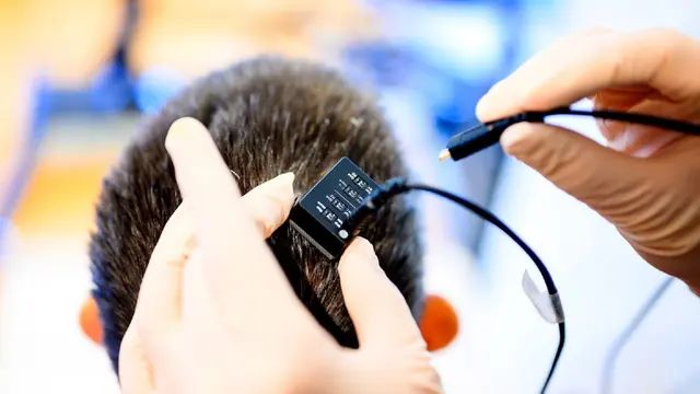 国内首位半侵入式脑机接口受试者受访：从完全依赖他人喂食到能自己拿水杯、握汤匙(图1)