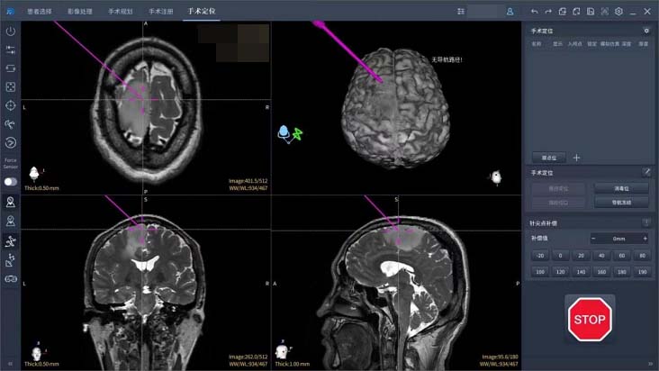 加拿大皇家科学院院士卓敏：脑科学破译情绪密码 开辟治疗新路径(图1)