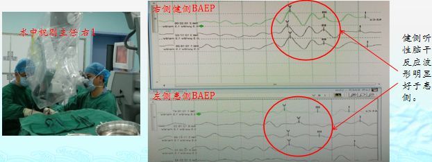 爱朋医疗：围术期脑状态监测产品在江西省已产生销售收入(图1)