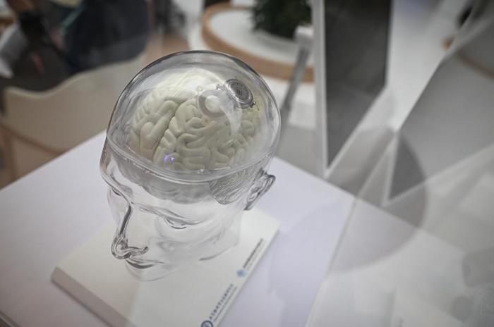 脑机接口正“接入”生活(图2)