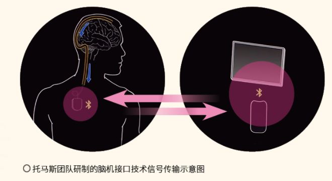 脑机接口技术如何让意识发声？(图2)