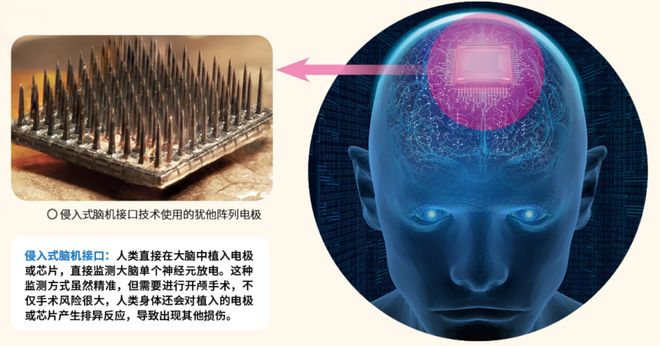 脑机接口技术如何让意识发声？(图3)