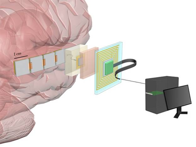 国内脑机接口产业升温 板块行情向好技术落地加速渗透(图1)