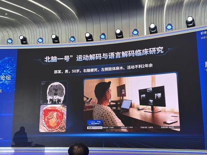 脑机接口站上风口我们离“意念操控”还有多远？(图1)