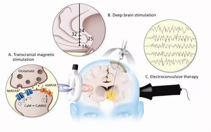 CMEF释放强信号：当AI重塑诊疗时灵析生物已在定义“医疗级可穿戴”的下一代标准(图1)