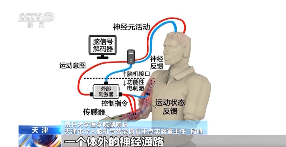 脑机接口技术取得新突破产业化有望再提速(图1)