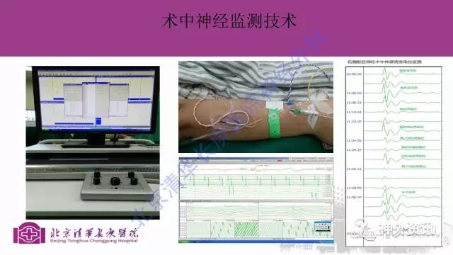 神经系统疾病监测护理技术(图1)