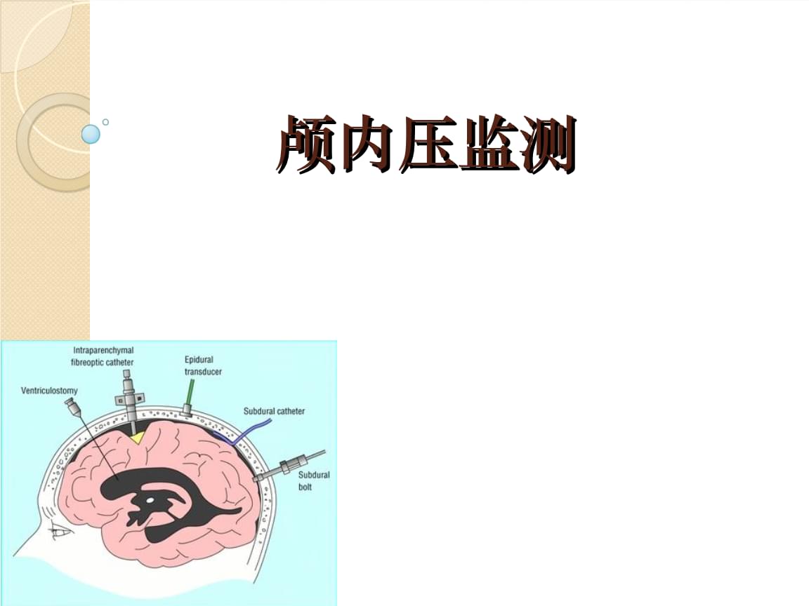 麦澜德：5月18日接受机构调研包括知名机构明汯投资的多家参与(图1)