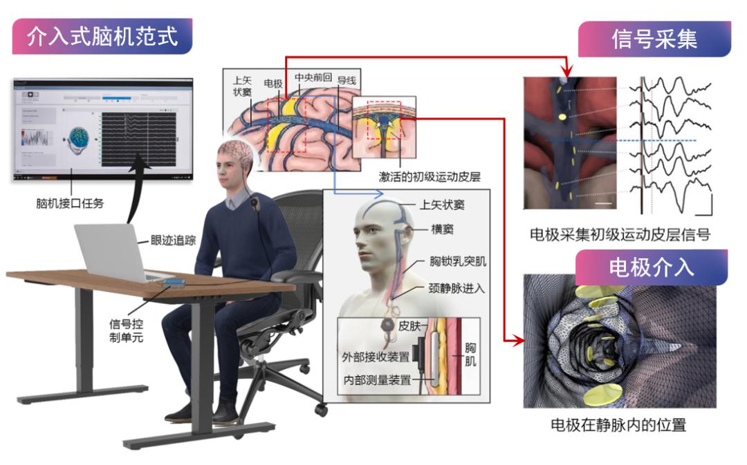 广州新增脑机接口技术研究和临床转化平台(图1)