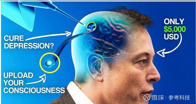 脑机接口临床转化的“宣武实践”(图1)