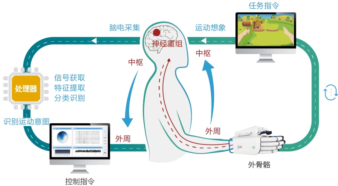 城记上海“脑智天地”交“周岁”答卷三大优势打通脑机接口全链条(图1)